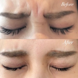 before-after
